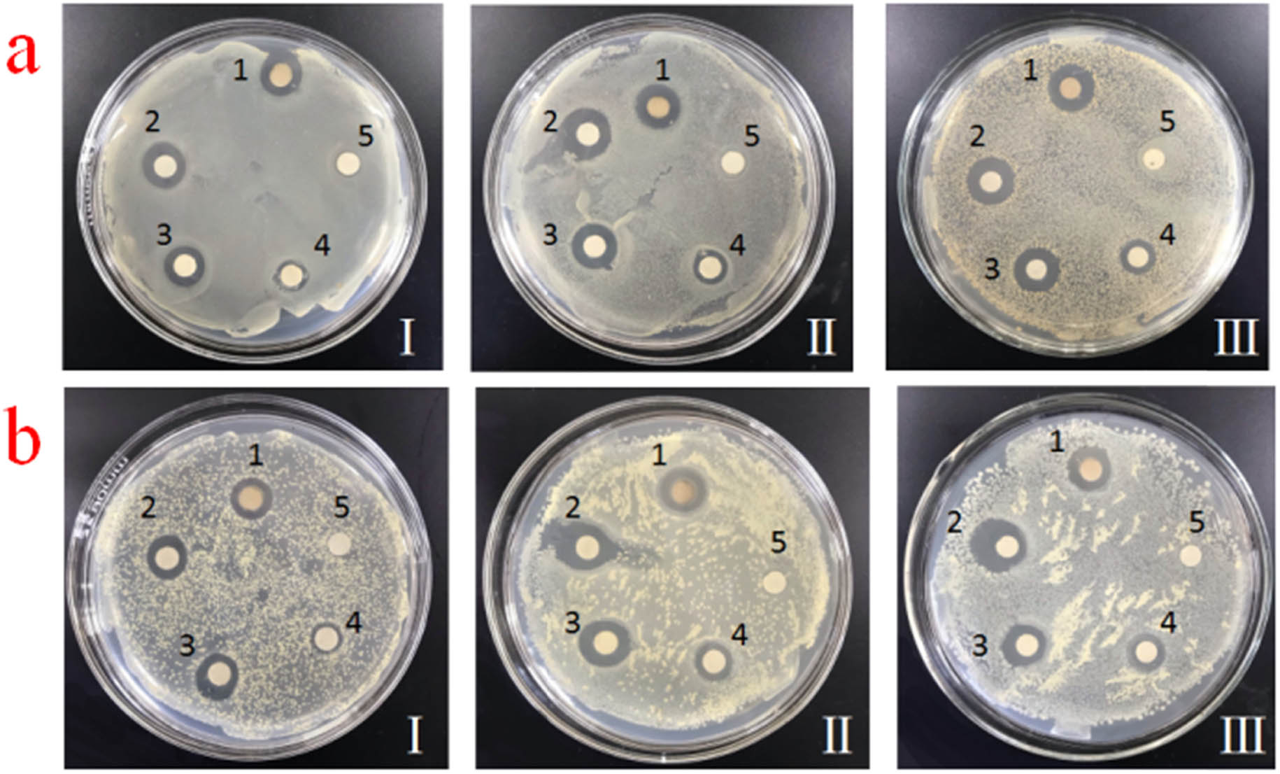 Figure 6 
                  Representative images of agar plates containing (1) CQDs/mesoporous SiO2/Ag NPs, (2) Ag NPs, (3) mesoporous SiO2/Ag NPs, (4) CQDs/mesoporous SiO2 and (5) CQDs, and inhibition zones for (a) E. coli and (b) S. aureus （diluted 10 times (Ⅰ), 102 times (Ⅱ), and 103 times (Ⅲ), respectively).
               