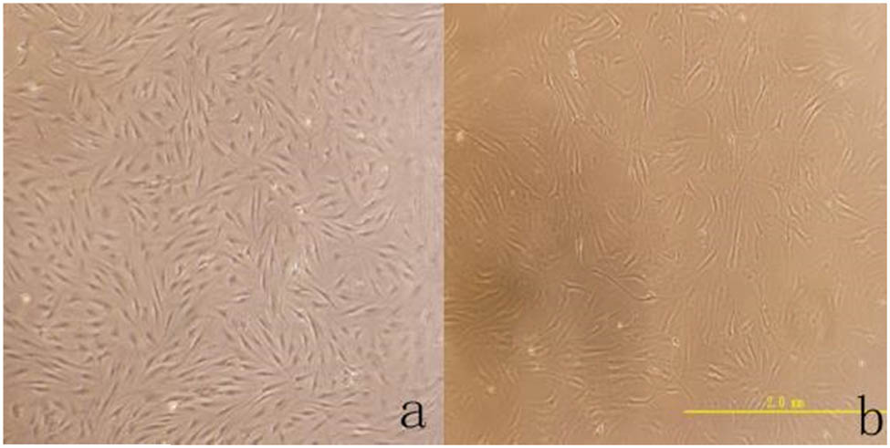 Figure 1 
               (a) The shape of the cells is fusiform, and the growth trend is swirled (×40). (b) Further observation of cell morphology and the size of the cell is about 30–50 μm (×200).
            