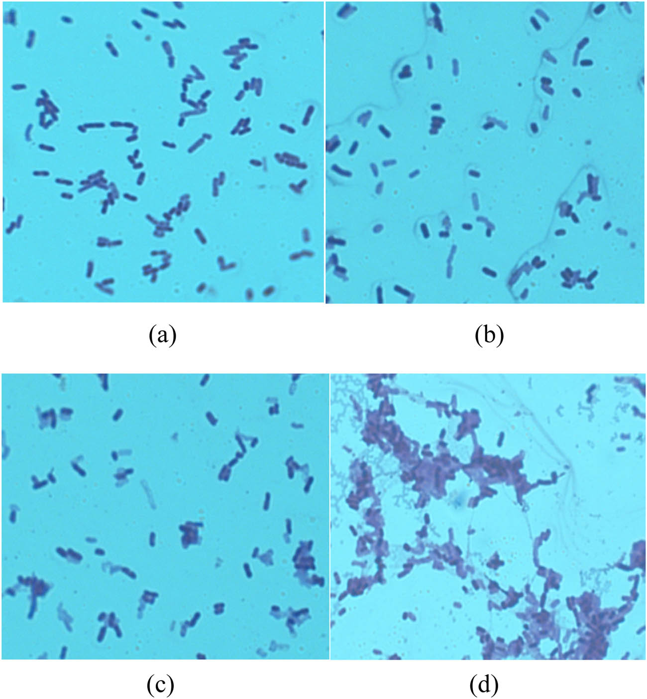 Figure 4 
                  Microbe morphology under different ultrasonic power: (a) 0 W, (b) 100 W, (c) 200 W, and (d) 300 W.
               