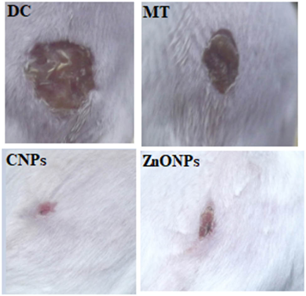 Figure 8
Images of wound closure in animals after lesioning (DC) and treatment with metformin (MT), gold–silver nanocomposite (CNPs), and zinc oxide nanoparticles (ZnONPs) at the end of the experimental period.