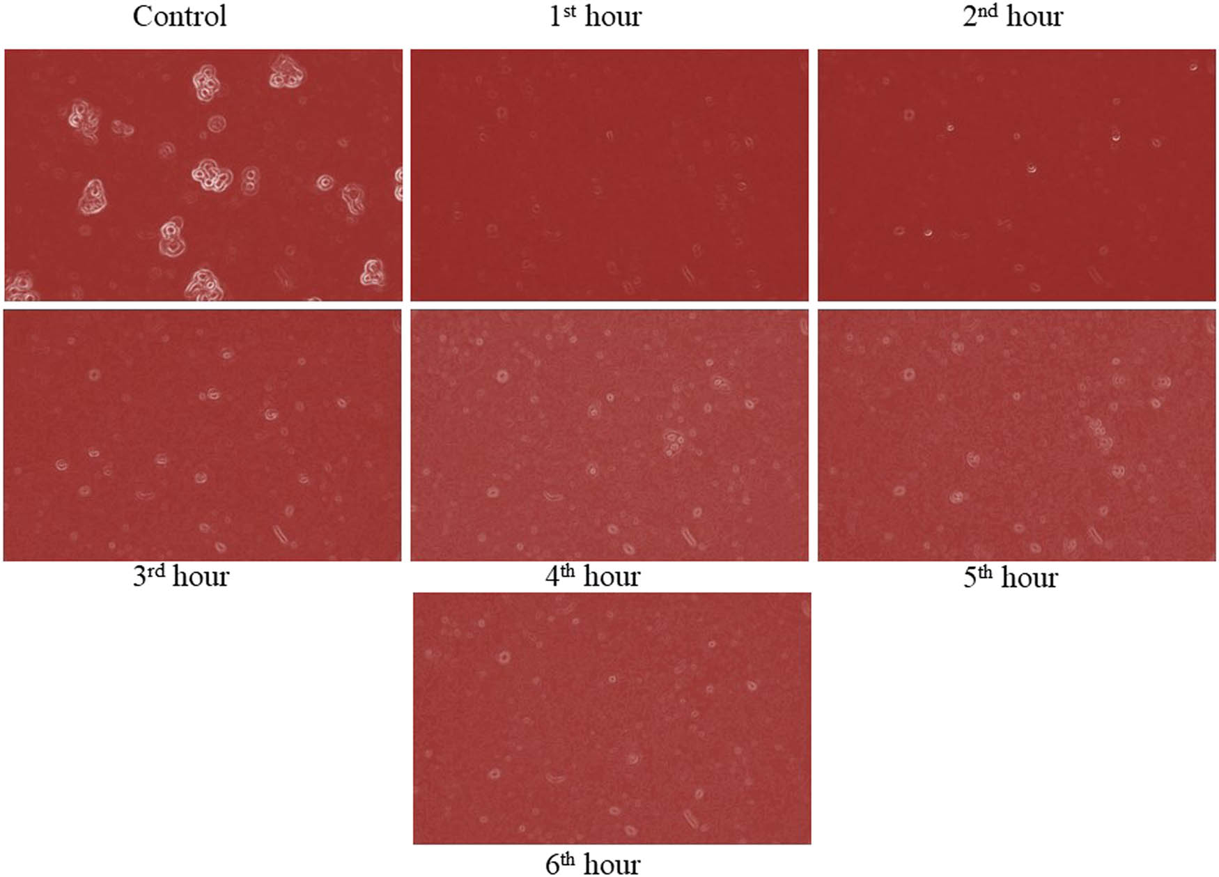 Figure 4 
                  Anticancer activity of pure TiO2.
               