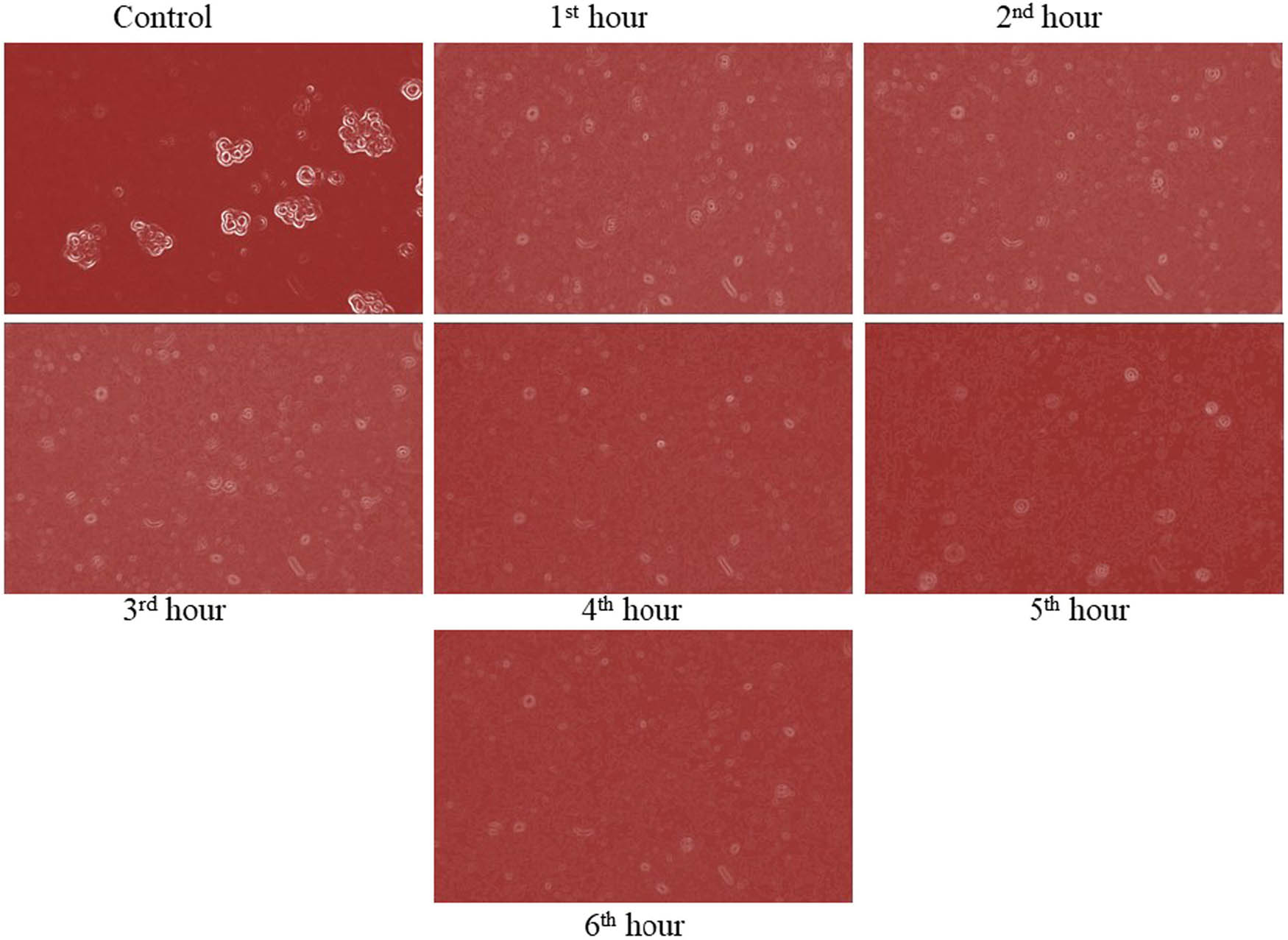 Figure 5 
                  Anticancer activity of Ce-doped TiO2.
               