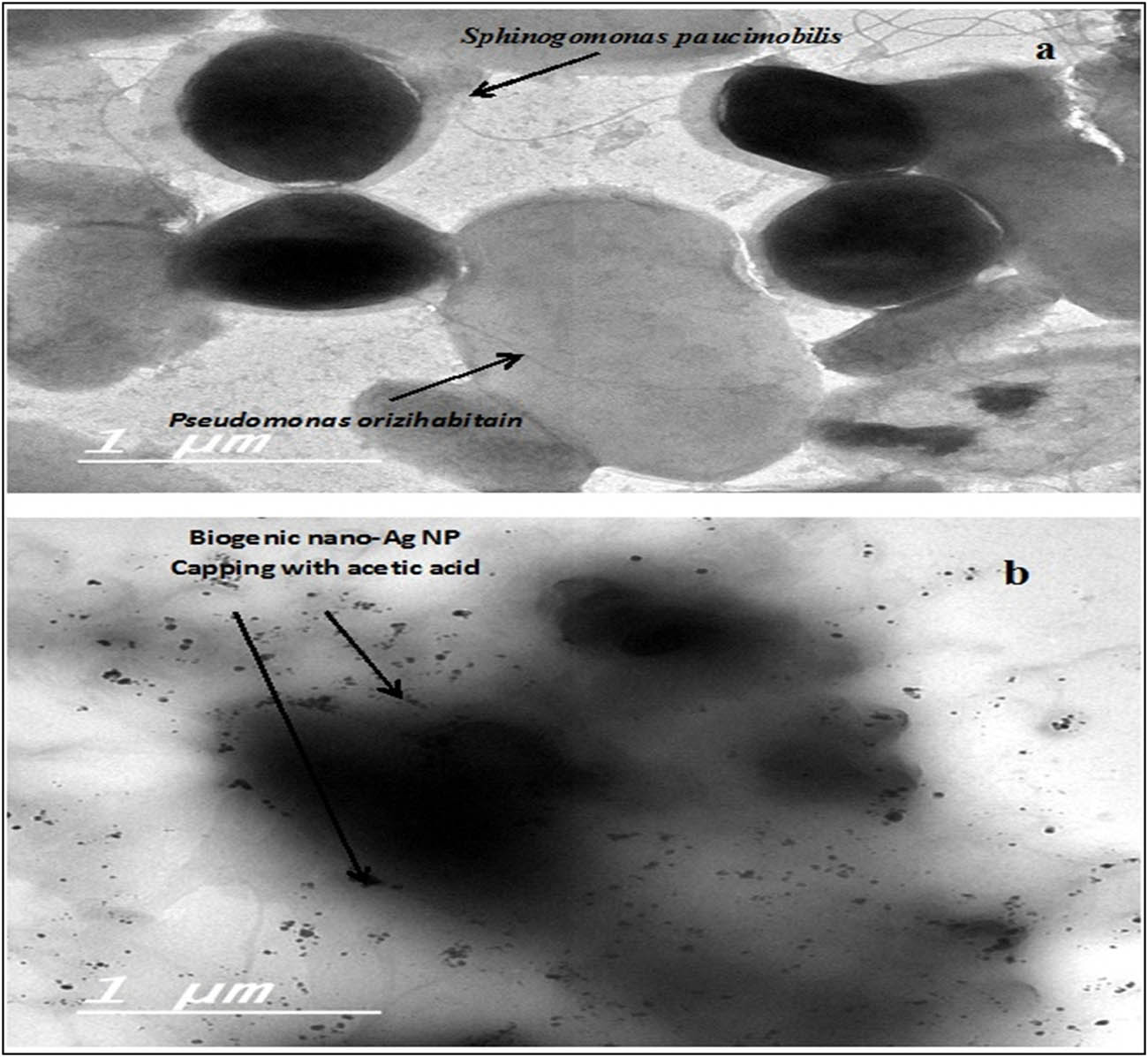 Figure 6 
                  HRTEM examination of detected bacteria (a) and morphological effect of biogenic (AgNPs) capping with acetic acid in intestinal microbiota of broker chicken (b).
               