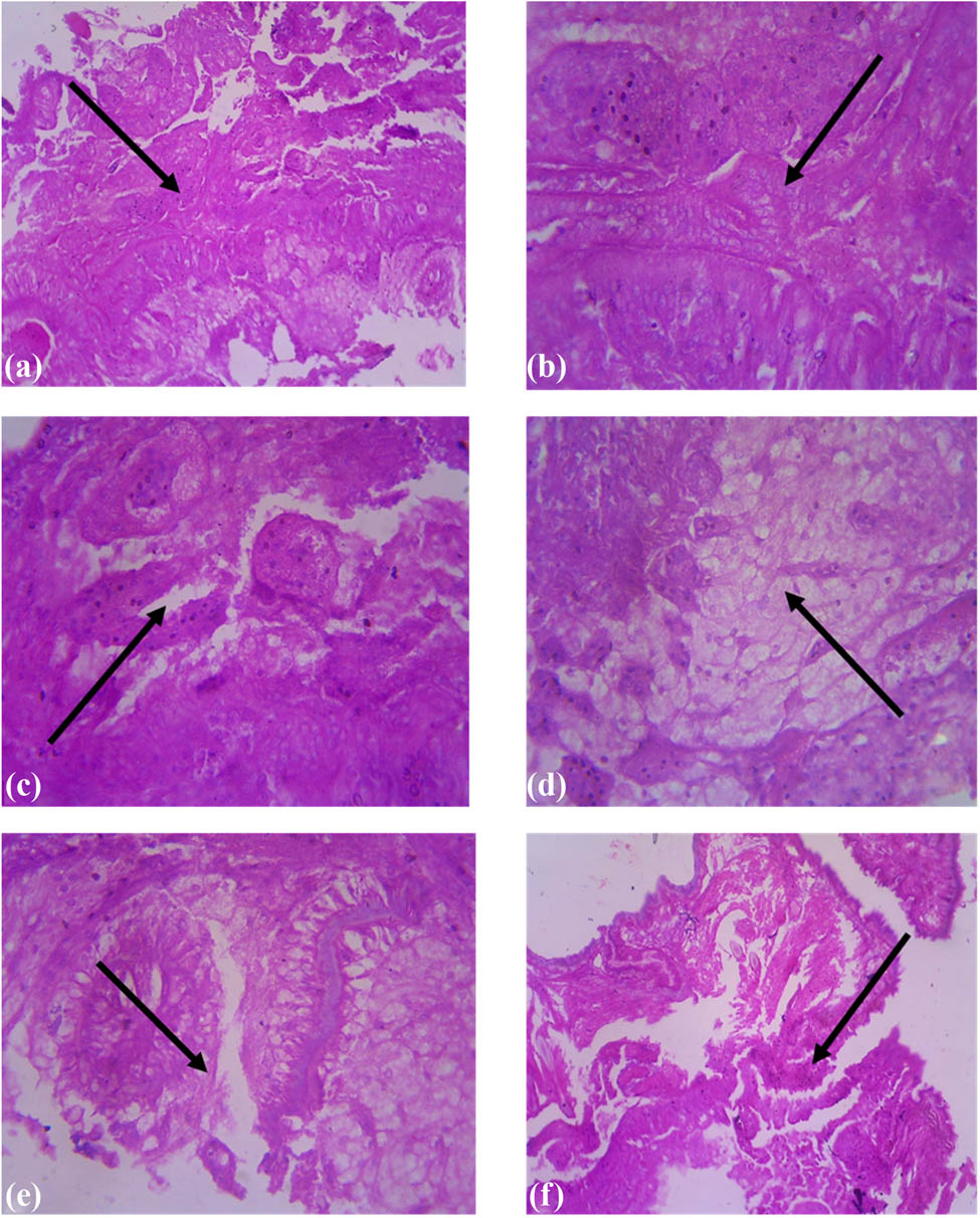 Figure 4 
               Histopathology of P. posthuma treated upon D. viscosa: (a) physiology of P. posthuma treated upon aqueous extract of D. viscosa; (b) treatment of ethanolic extract of D. viscosa; (c) treatment of methanolic extract of D. viscosa; (d) treatment of chloroform; (e) treatment upon petro benzene extract of D. viscosa; and (f) treatment of albendazole standard drug shows the entire physiology of P. posthuma was collapsed by the treatment.
            