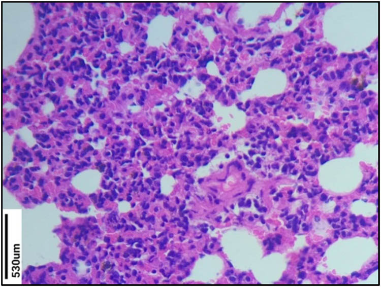 Figure 4 
                  Histopathological study of Group V lung section (control group). No changes were observed in the normal control group.
               