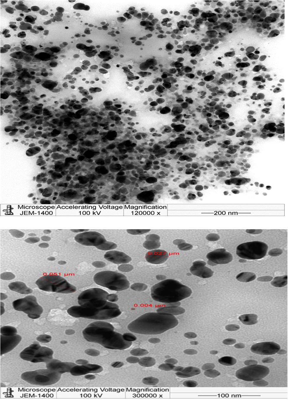 Figure 3 
                  Transmission electron microphotograph showing the morphology and size of synthesized Si-AgNPs.
               