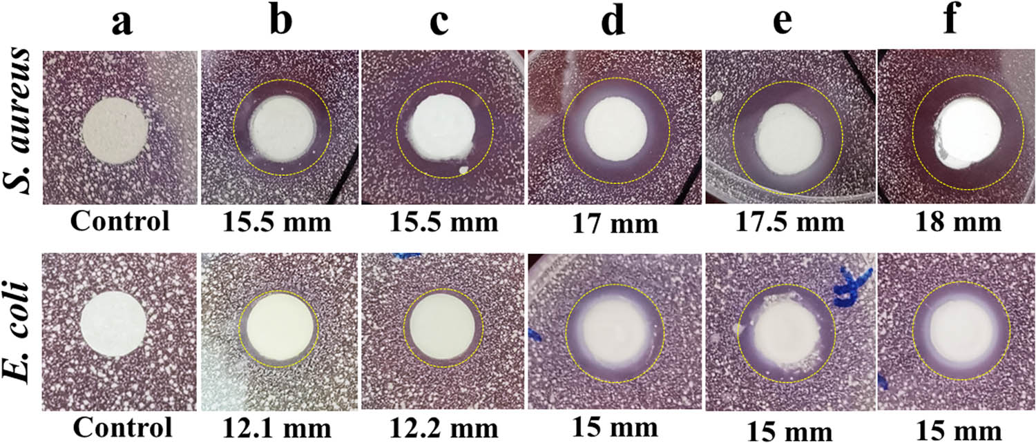 Figure 6 
                  The inhibition zone diameters of ZnO/APT nanocomposites with different loading amounts of ZnO. The alphanumeric numbers of a–f refer to control groups, ZnO/APT-5%, ZnO/APT-10%, ZnO/APT-20%, ZnO/APT-30%, and ZnO/APT-40%, respectively.
               