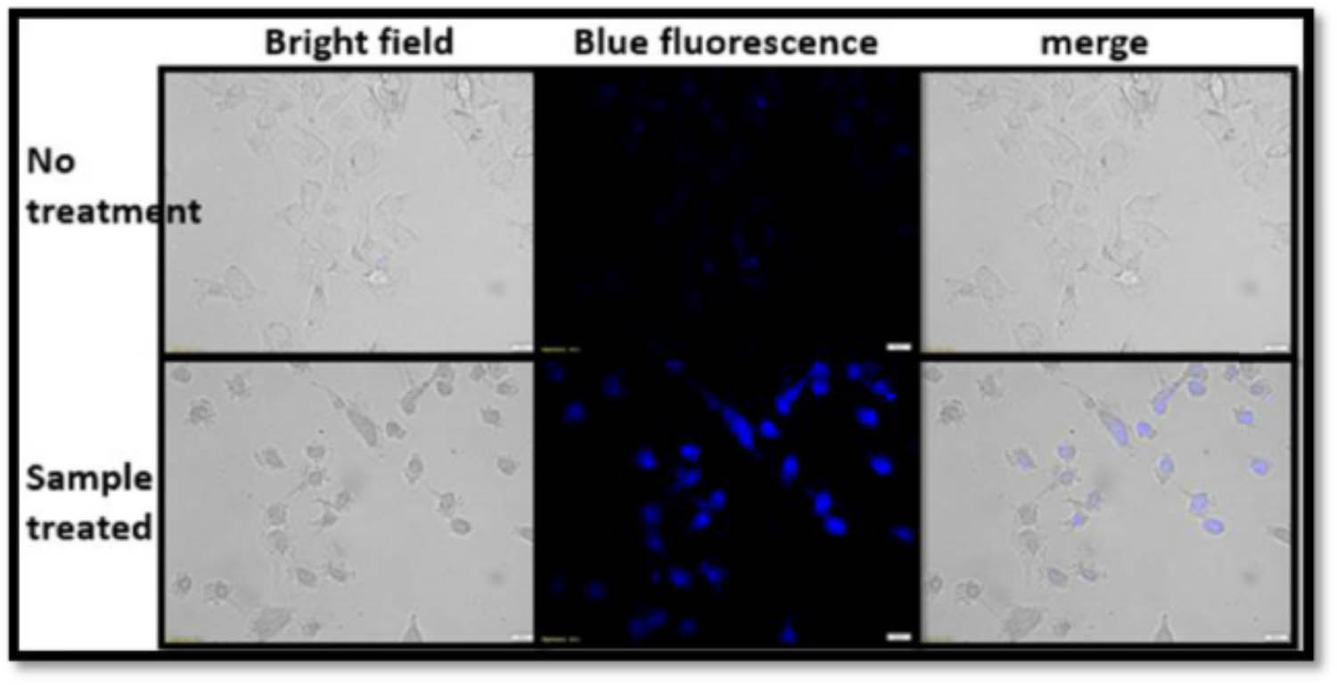 Figure 4 
               Confocal microscopy images of cancer prostate epithelial RWPE-1 cells utilizing MDGOs as a sensing material [52]. Copyright © 2022; Elsevier.
            