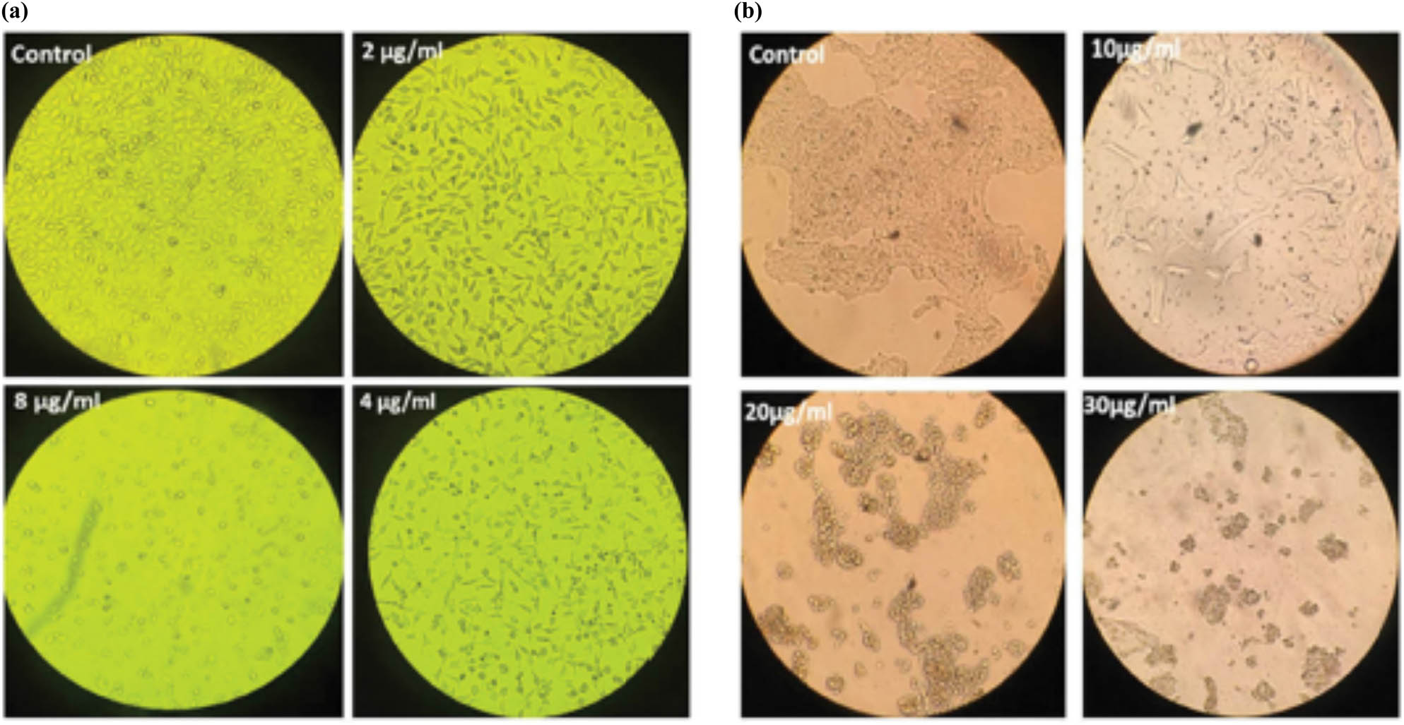 Figure 14 
               Flow cytometry detection of the morphology and cell cycle status of treated cell lines. (a) MCF7 cell line morphology at various ZnONPs treatment doses compared to untreated control cells. At high concentrations, their morphology shows apoptotic death. (b) The morphology of the TUBO cell line after various doses of ZnONPs treatment in comparison to untreated control cells. At high ZnONPs concentrations, apoptotic death might also be observed in the MCF7 cell line [67]. Copyright © 2019; Wiley Online Library.
            
