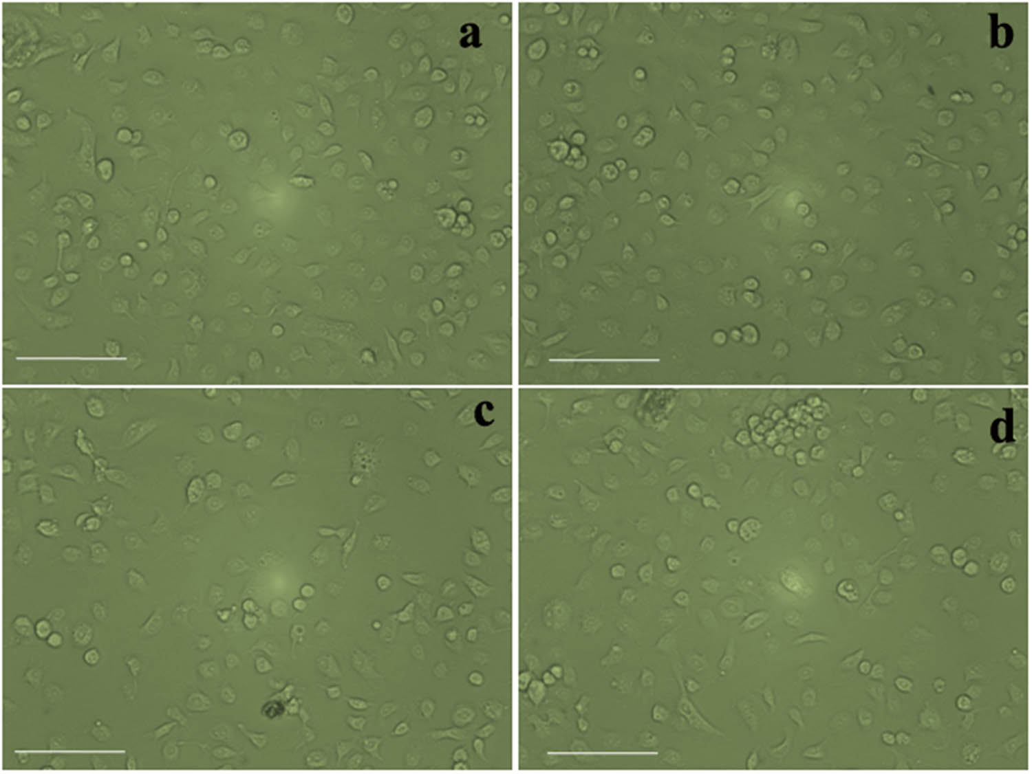 Figure 7
Morphological observation of synthesized AgNP-treated Vero cells: (a) control, (b) 25 μg·mL−1, (c) 50 μg·mL−1, and (d) 100 μg·mL−1.
