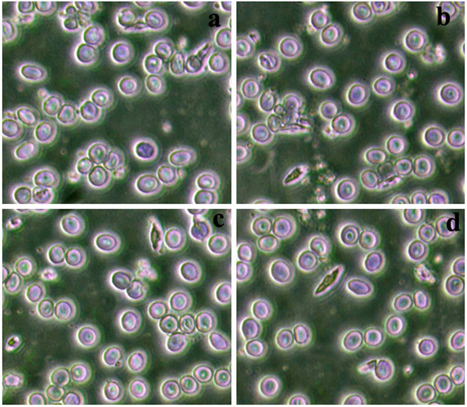 Figure 9
Antiplasmodial activity of the synthesized AgNPs against P. falciparum: (a) control, (b) 50 ppm, (c) 75 ppm, and (d) 100 ppm.