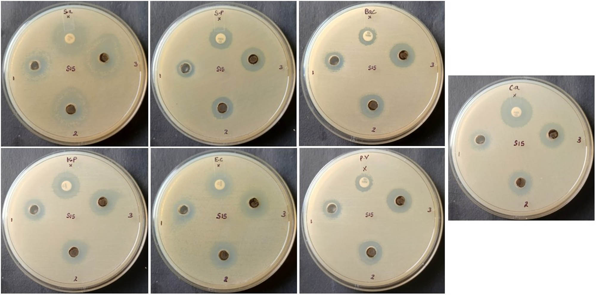 Figure 6 
                  Antimicrobial activity of the synthesized GO/Mn/Ch/FA-Brucine NCs. The treatment of various concentrations of the synthesized GO/Mn/Ch/FA-Brucine NCs effectively decreased the growth of tested pathogens, particularly E. coli, S. aureus, and C. albicans, which were more sensitive to the NCs.
               