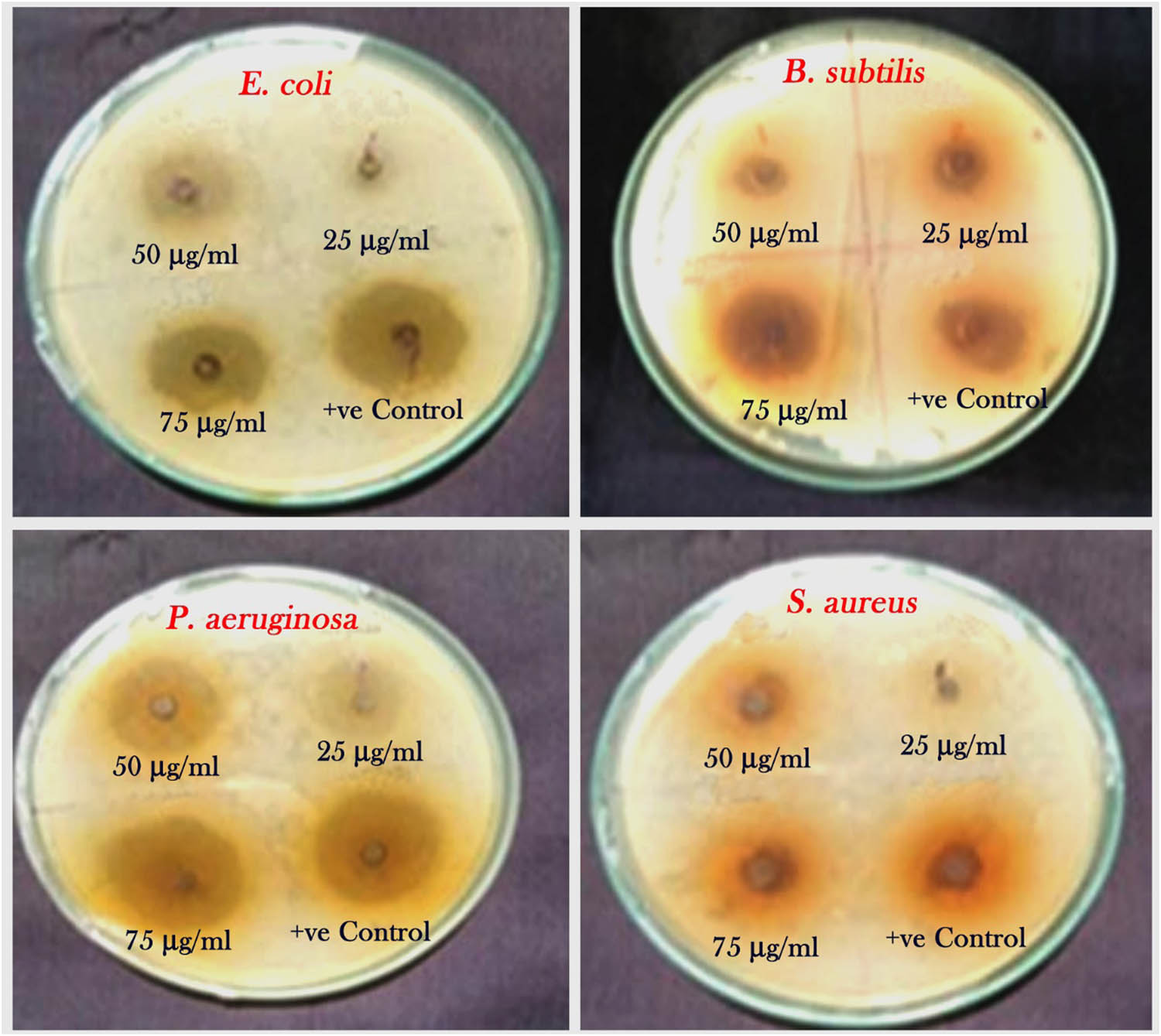 Figure 6
Antibacterial activity of L. inermis aqueous extract tested against human clinical pathogens at different concentrations.
