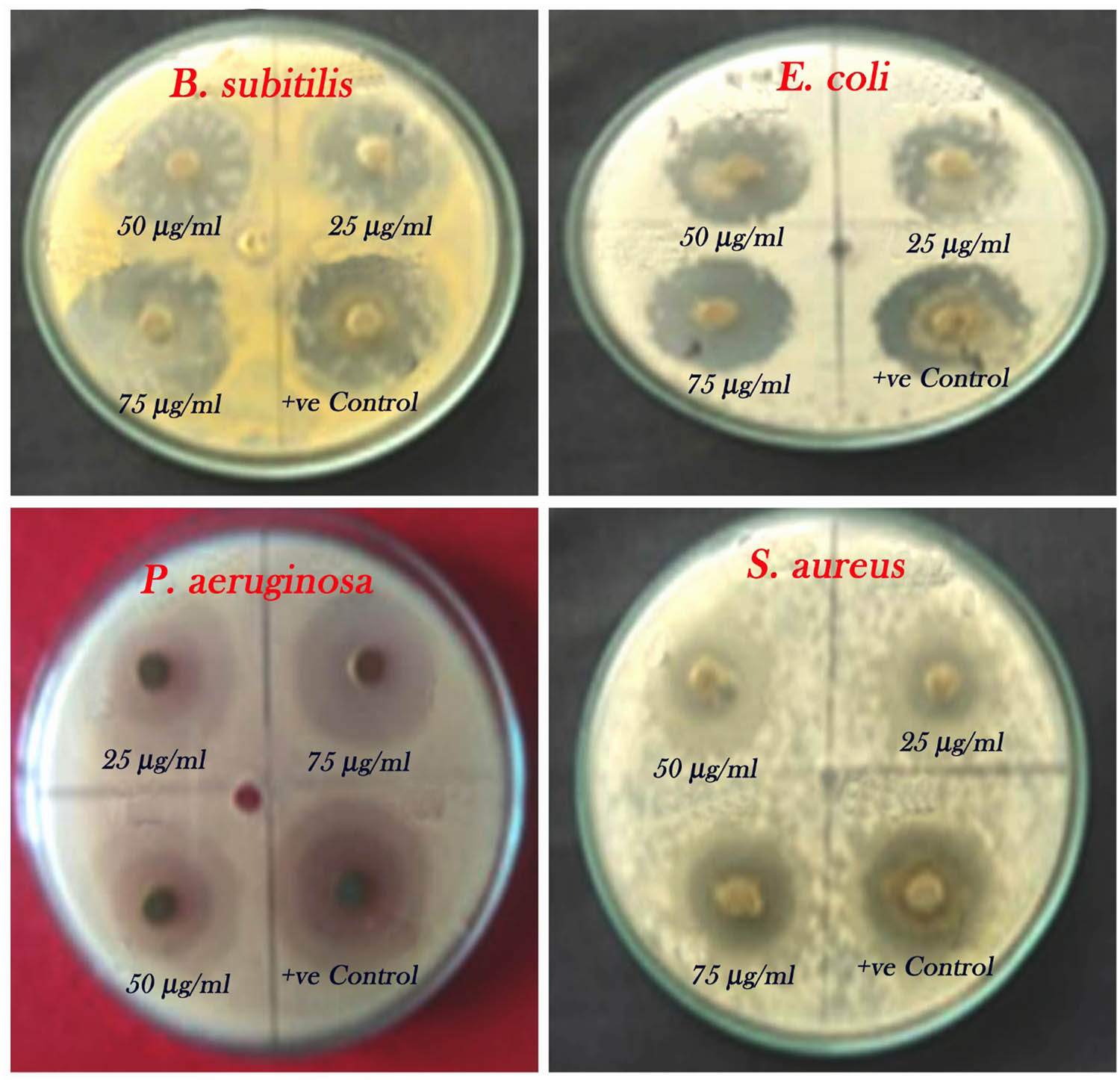 Figure 7
Antibacterial activity of synthesized Ag–Cu NPs tested against human clinical pathogens.