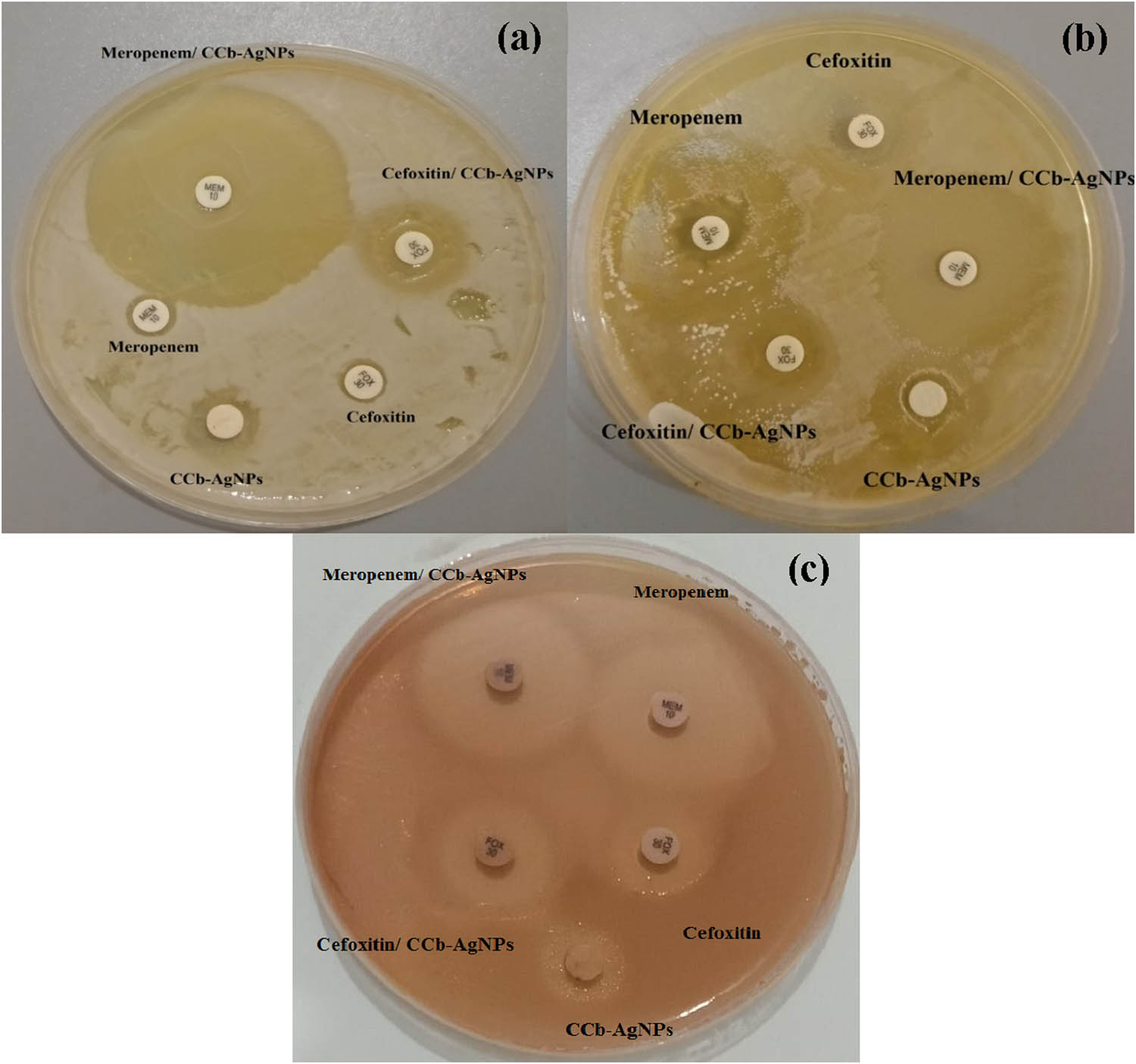 Figure 10 
                     Antibacterial activity (zone of inhibition) of CCb-Ag-NPs against E. coli (ATCC 25922) (a), E. coli (ATCC 8739) (b), and P. aeruginosa (ATCC 90274) (c).
                  
