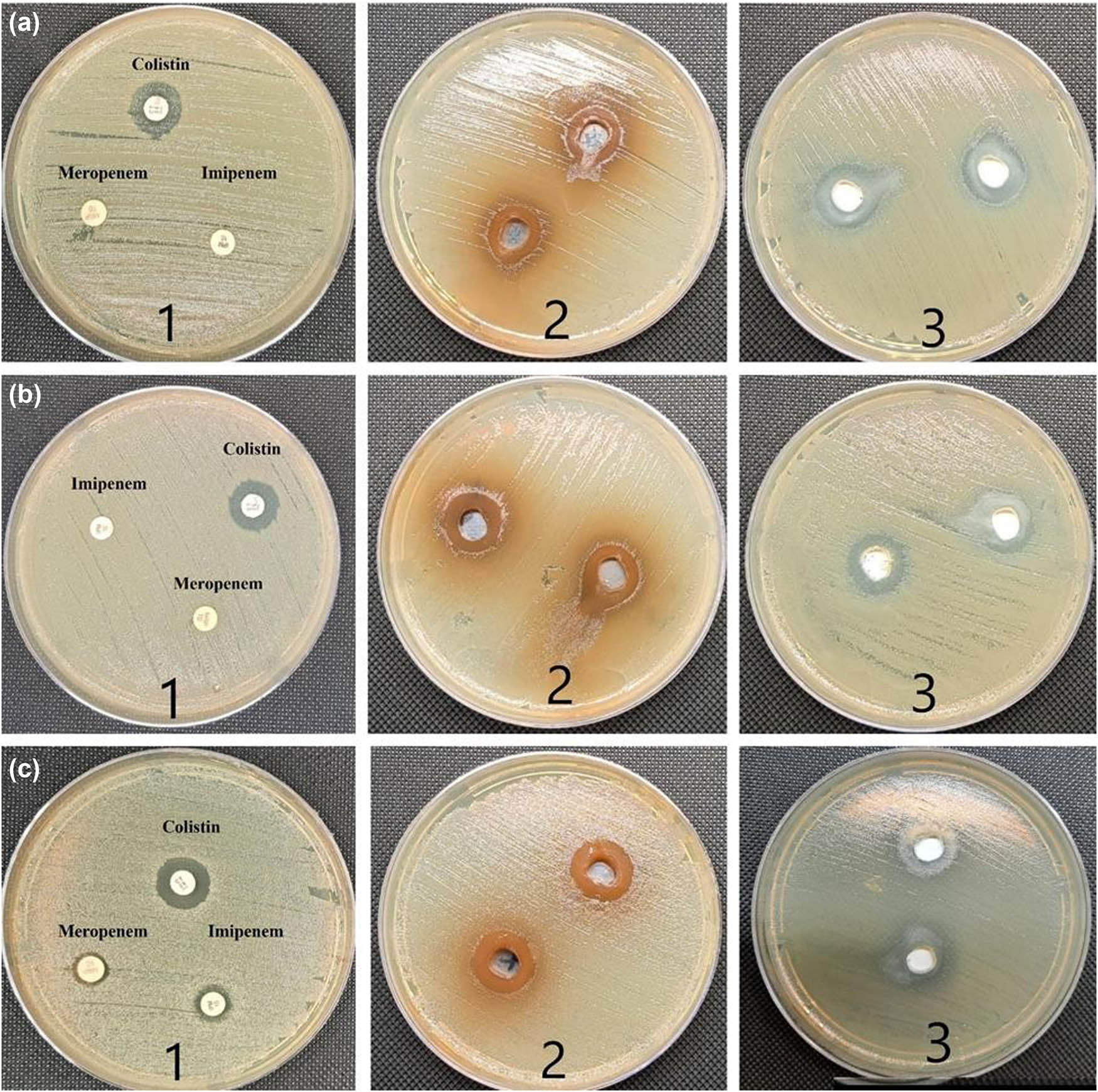 Figure 3 
                  (a1) and (c1) ZI of imipenem, meropenem, and colistin antibiotics against CRKP, which showed no inhibition zone with meropenem and imipenem and weak inhibition zone with colistin. (a2) and (c2) A. nilotica aqueous extract against CRKP (ATCC) at 7.5 mg·mL−1 concentration showed wide inhibition zone with both clinical samples of colistin-resistant bacteria. (a3 and c3) ZnO-NPs against CRKP at concentration of 7.5 mg·mL−1 showed a wide inhibition zone against both tested clinical isolates. (b1–3) ZI of imipenem, meropenem, colistin, A. nilotica aqueous extract, and ZnO-NPs against CRKP ATCC 700603 which revealed good susceptibility with both ZnO-NPs and A. nilotica extract, while weak response to the commercial antibiotics used.
               