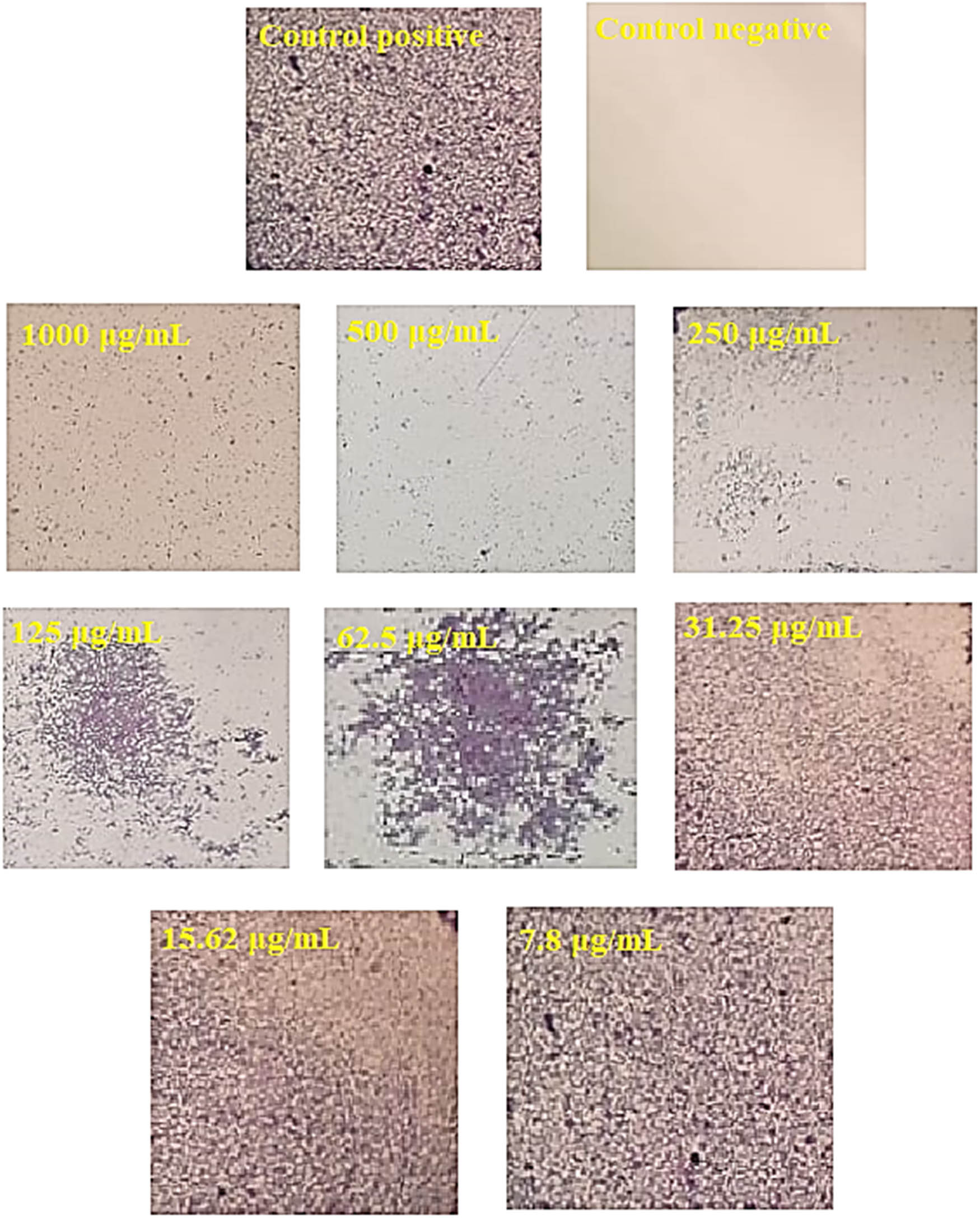 Figure 8
Microscopically light-inverted photos of MRSA biofilms developed with different conc. of Ag NPs.