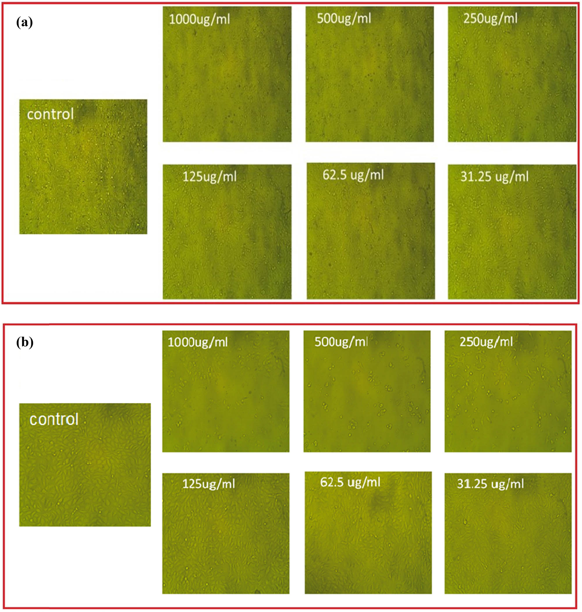 Figure 11
Silver NP effects on Vero cell (a) and Caco-2 tumor cell (b) at numerous concentrations.
