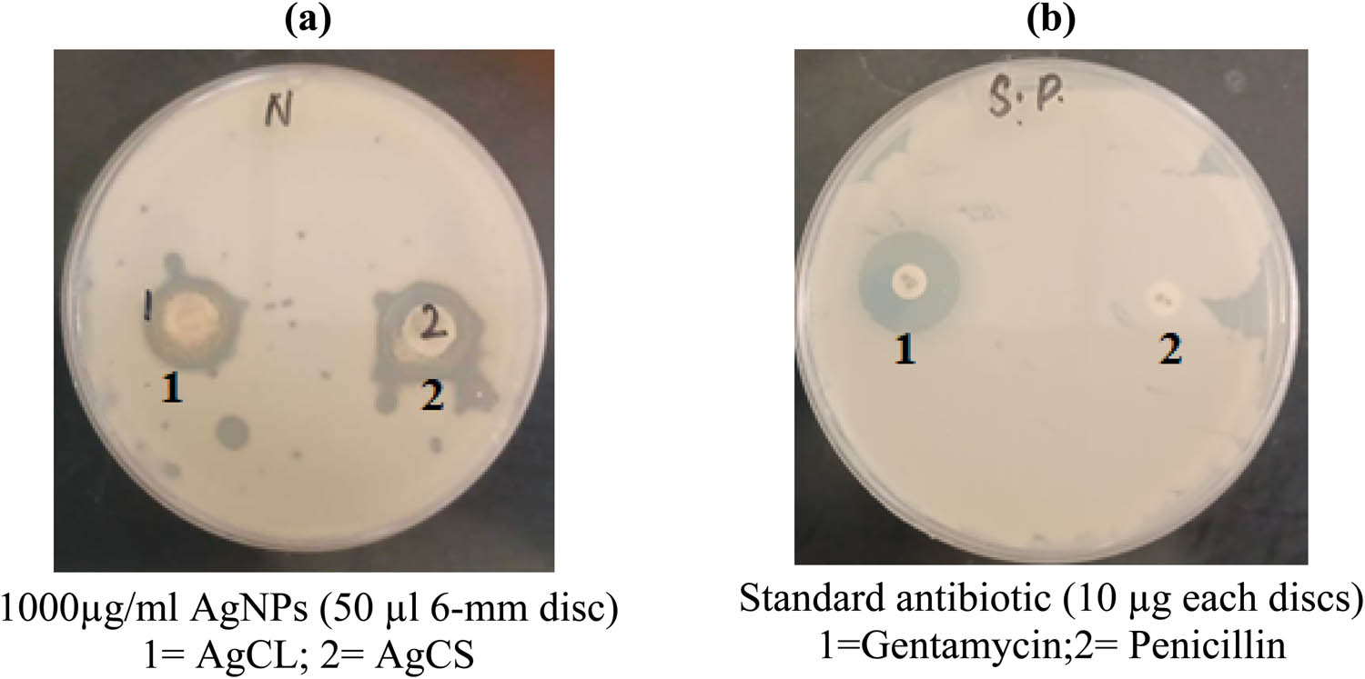 Figure 1
Agar plates the antibacterial activity of (a) AgNPs and (b) standard antibiotic against K. pneumonia.