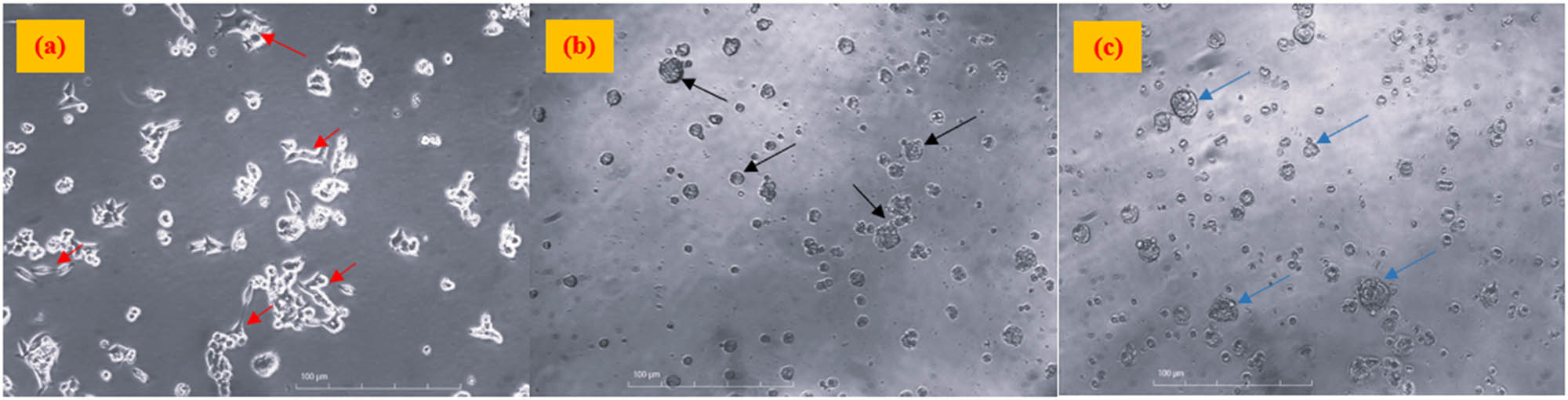 Figure 7 
                  Colorectal cancer cells (a) without treatment (negative control), (b) treated with cisplatin (positive control), and (c) treated with CuO/ZnO NCs at 100 μg·mL−1 with 10× magnification. Note: The images were taken before the addition of MTT reagents. Red arrows show the cells with elongated shapes, whereas black and blue arrows show irregular to round shape cells after treatment.
               
