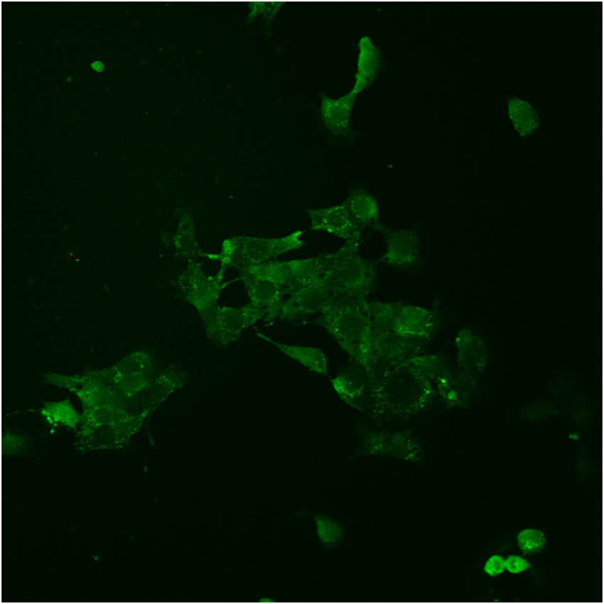 Figure 6
Two-photon fluorescence cell microscopic imaging of 4T1 cells.