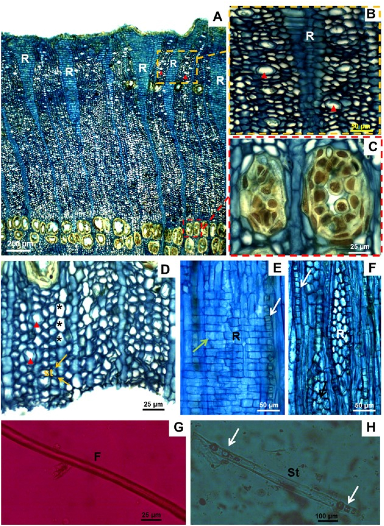 Figure 7: 
Anatomical aspect of the bark of Vismia guianensis. (A) Extension of the transverse plane, showing wedge-shaped ray dilatation tissue [R] and tangential cord formed by secretory channels in demarcated areas; (B) secretory cells [red triangle] and (C) secretory channels containing exudates; (D) conductive phloem, with expanded parenchyma cells [*], arrow pointing to companion cells of the tube element [st] and secretory cells [red triangle]; (E) radial longitudinal section showing cells of radius [R], with the occurrence of crystalline sand [green arrow] and prismatic crystals in rows [white arrow]; (F) tangential longitudinal section, showing radius [R] and crystals in the axial parenchyma cells [arrow]; (G) fibres [F]; (H) tube element [st, arrow].

