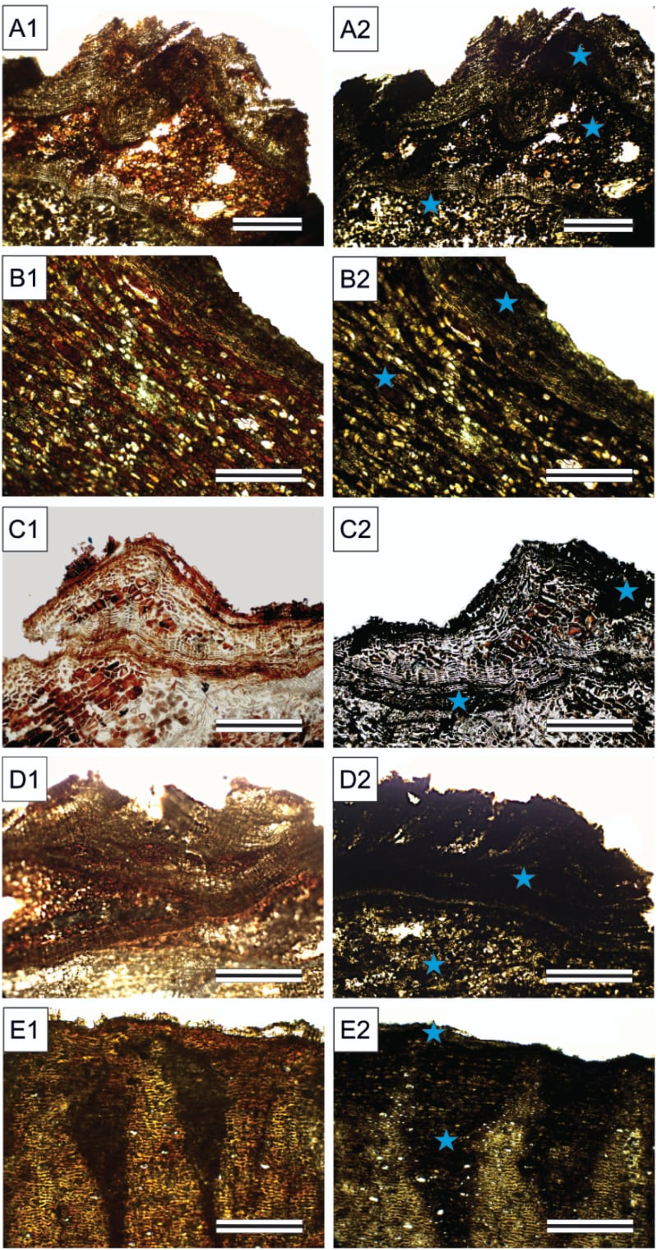 Figure 8: 
Histochemical tests for the detection of phenolic compounds in the barks. (A1 and A2) Byrsonima spicata; (B1 and B2) Croton matourensis; (C1 and C2) Myrcia splendens; (D1 and D2) Tapirira guianensis; (E1 and E2) Vismia guianensis. A1–E1 [control], A2–E2 [ferric chloride test], stars [examples of sites with positive reaction]. Scales: 800 µm (A1 and A2), 400 µm (B1–E2). Magnification: 4× (A1 and A2), 10× (B1–E2).
