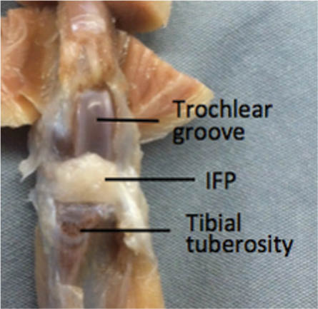 Figure 2: Representative gross image of the IFP from an obese 5-month-old guinea pig.The joint capsule, synovium, and patella have been removed to allow exposure of this fat depot.