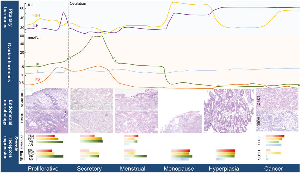Figure 1: Correlation of typical hormonal changes of pituitary/ovarian axis with the consequential endometrial morphology and steroid hormone expression in women.Pituitary and ovarian hormones show typical cyclical variations during the premenopausal period and these change at menopause. The correspondent endometrial morphology and epithelial steroid receptors expression in normal [pre and postmenopausal (PM)], premalignant [endometrial hyperplasia (EH) with atypia] and malignant (low-grade endometrial cancer, LGEC and high-grade endometrial cancer, HGEC) endometrium is shown in the panels.