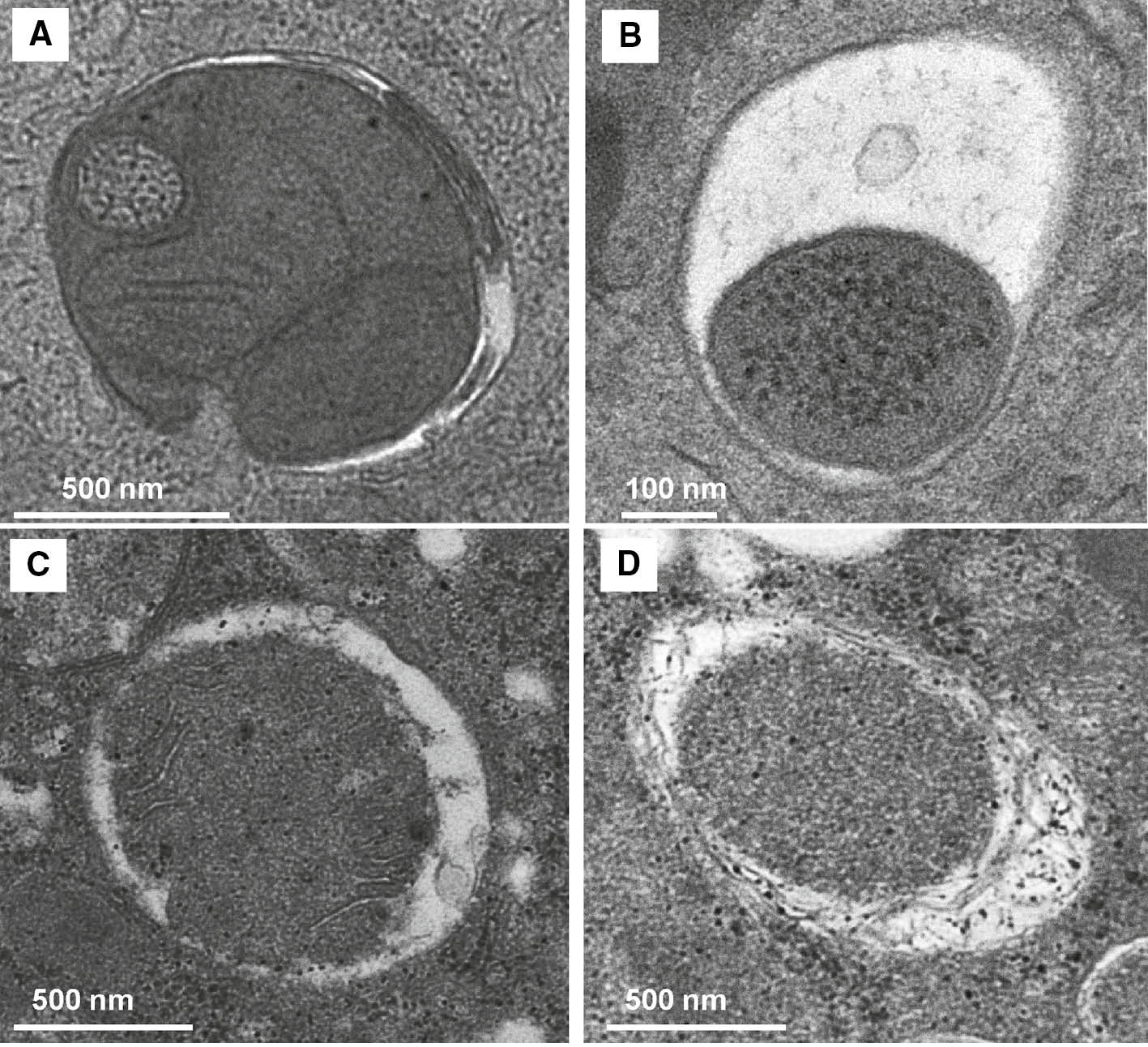 Figure 3: Electron microscopic (EM) depiction of mitophagy.Wild type C57BL/6 mice were treated with acetaminophen (i.p., 500 mg/kg) for 6 h (panels A, B) or ethanol (gavage, 4.5 g/kg) for 6 h (panels C, D). Thin liver sections were processed for EM studies. Panels (A, C) show an early double-membraned autophagosome enveloping mitochondria; panels (B, D) show a late autolysosome containing degrading mitochondria.