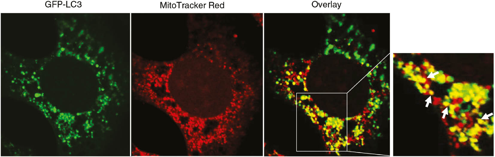 Figure 4: Confocal microscopy for the co-localization of autophagosomes with mitochondria.GFP-LC3-expressing MEFs were first loaded with MitoTracker Red (50 nm, ThermoFisher Scientific, USA) for 30 min and then treated with CCCP (30 μm) plus the lysosomal protease inhibitors E64D (10 μm) and Pepstatin A (10 μm) for 6 h. The cells were fixed with 4% paraformaldehyde followed by confocal microscopy. Arrows: yellow dots represent co-localized GFP-LC3 positive autophagosomes with red fluorescence labeled mitochondria.