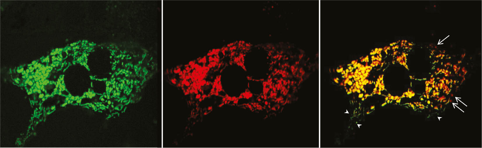 Figure 5: Confocal microscopy for monitoring mitochondria biogenesis in primary hepatocytes infected with AAV-Mito-Timer.Primary mouse hepatocytes were infected with AAV-TBG-MitoTimer (1000 GC/cell) for 72 h. Hepatocytes were fixed with 4% paraformaldehyde in PBS followed by confocal microscopy. Arrows: red-only old mitochondria; arrow heads: green-only newly synthesized mitochondria.