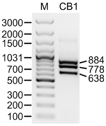 Figure 1: RT-PCR analysis of AtCathB1 transcripts.RT-PCR analysis was performed on RNA extracted from A. thaliana rosette leaves using primers encompassing exons 2–6 of the AtCathB1 (CB1) coding region. PCR products were then separated by 1.5% agarose gel electrophoresis and visualized by ethidium bromide staining. The migration positions of DNA standards (M) are indicated, with their respective masses expressed in base pairs.