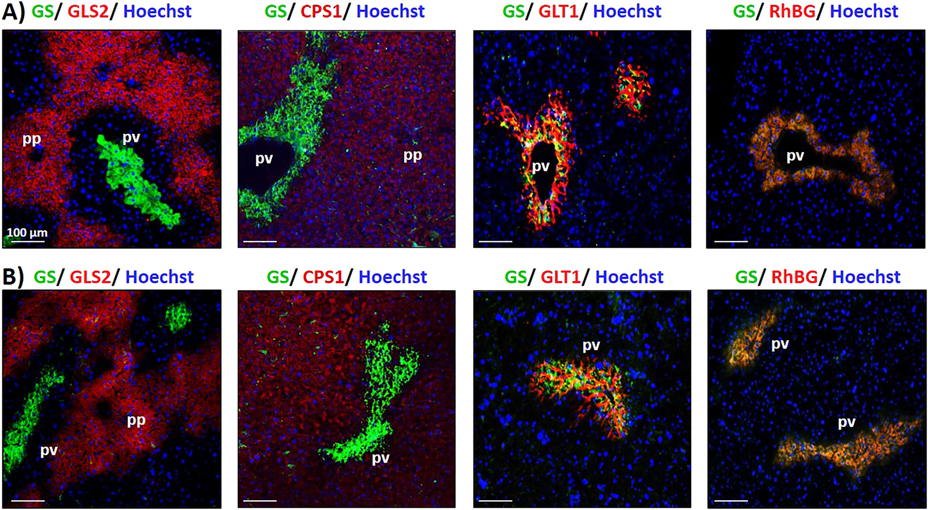 Figure 1: 
Metabolic zonation of the liver.
Immunofluorescence analyses of glutamine synthetase (GS), glutaminase 2 (GLS2), carbamoylphosphate synthetase 1 (CPS1), glutamate/aspartate transporter II (GLT1) and ammonium transporter Rh type B (RhBG) protein in (A) mouse and (B) rat liver sections. Cell nuclei were counterstained with Hoechst 34580.
