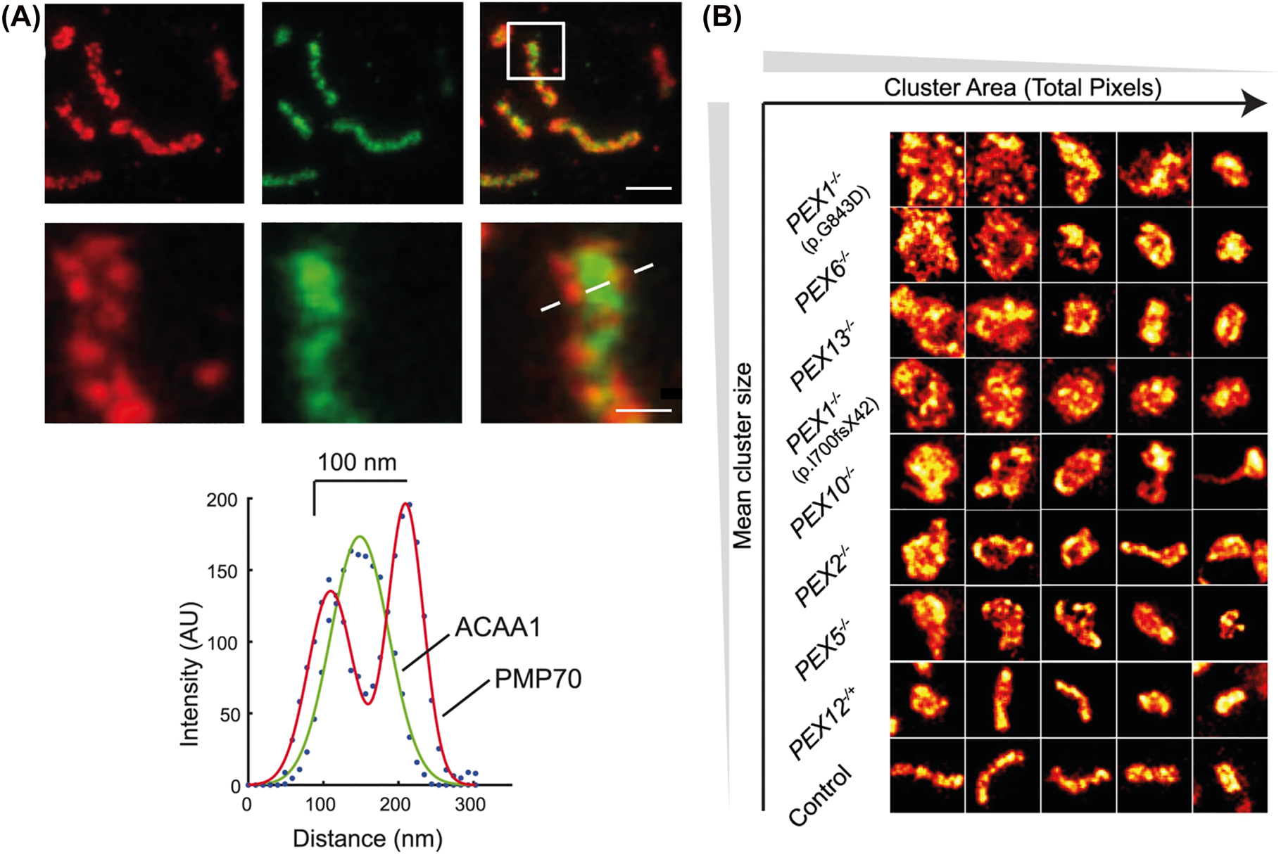 Figure 4: 
STED microscopy of peroxisomes in fixed human skin fibroblasts. (A) Two-color STED microscopy of peroxisomal membrane (PMP70, red) and matrix (anti-acetyl-CoA acyltransferase1, anti-ACAA1, green), and merged images of both (right): overviews (upper panels) and zoom-ins of marked area (lower panels), and intensity line profiles along dotted line. Scale bars 500 nm (upper) and 100 nm (lower). (B) ZSS patient peroxisomal ghost analysis: STED microscopy image tiles (1000 × 1000 nm) of peroxisomal membranes form patient fibroblasts immunostained for PMP70, indicating that PBD is associated with an increase in peroxisome circularity. Adapted from Soliman et al. (2018).
