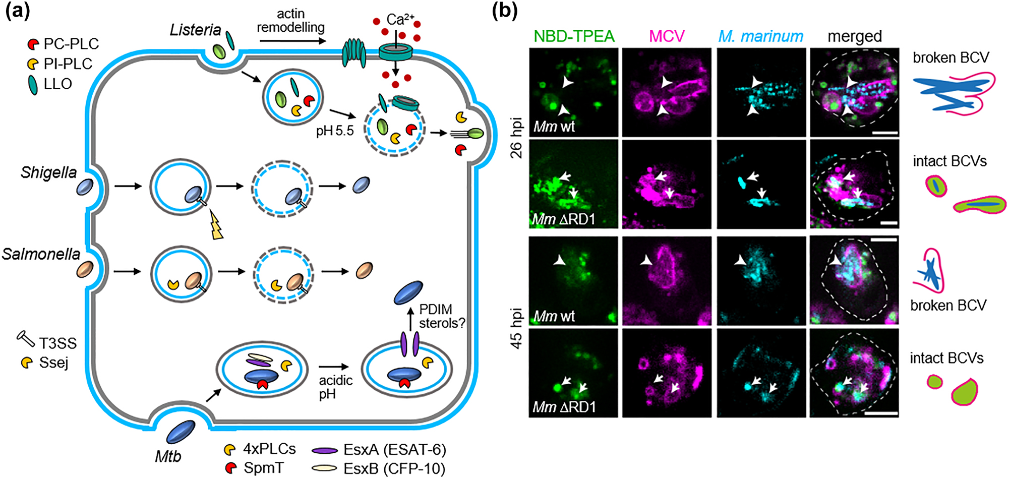 Figure 1:
Pathogen-inflicted membrane damage. (a) Listeria secretes the cytolysin LLO, the PLases PI-PLC and PC-PLC (with SMase activity) to trigger its own uptake, phagosome escape, and spreading into neighbouring cells. Salmonella secretes the PLase SseJ (with cholesterol acyltransferase activity), to destabilize the SCV membrane. The T3SS of Shigella is sufficient to mediate the escape of the bacteria into the cytosol. Mtb secretes the pore-forming peptide EsxA that acts together with PDIM to promote phagosome escape. (b) The M. marinum ΔRD1 mutant that lacks ESX-1 as well as EsxA (ESAT-6) fails to damage the MCV membrane. While zinc, labelled with NBD-TPEA, leaks from damaged MCVs of M. marinum wild type, it accumulates in intact MCVs of the ΔRD1 mutant. BCV: bacteria-containing vacuole. Copyright © (Hanna et al. 2021).
