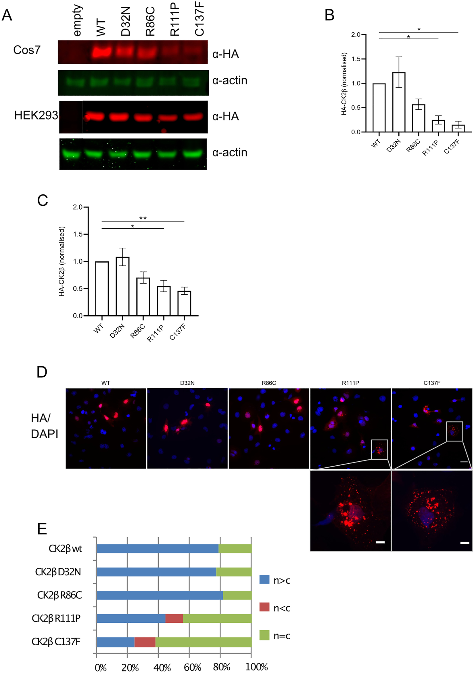 Figure 2:
Expression and subcellular localization of POBINDS linked mutant proteins. Immunoblotting of Cos7 and HEK293T lysates overexpressing WT and mutant HA-tagged CK2β mutants and β-actin (A) and quantification thereof (B) (Cos7), (C) (Hek293T). Cos7 cells, stained with anti-HA antibody and DAPI (D). White bar represents 30 and 10 μm in the zoomed image. Quantification of CK2α subcellular localization. For all conditions, more than 200 cells were counted, and three independent experiments performed (E).