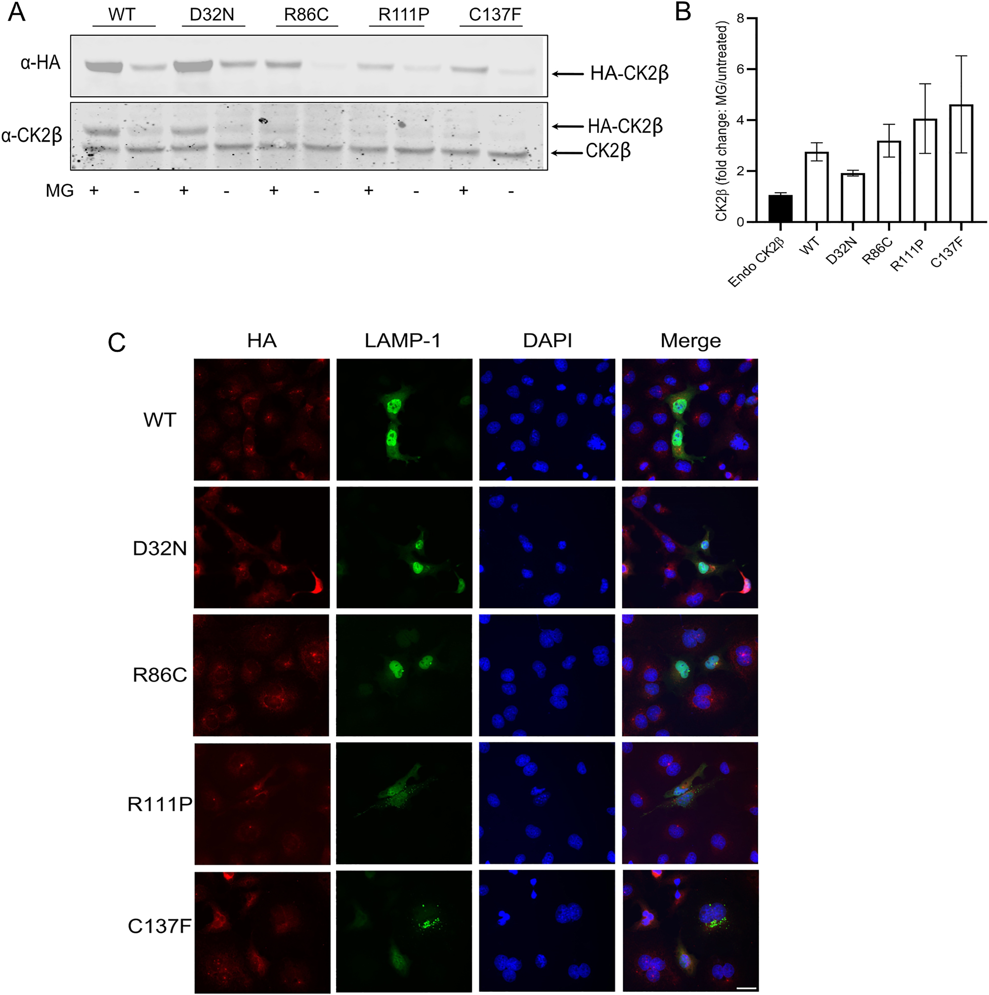 Figure 4:
Degradation of mutant proteins. MG132 (10 µM) was added to HEK293T cells expressing WT and mutant CK2β proteins overnight (16 h). 60 µg of protein lysate was analysed by Western blotting using anti-HA antibody (A). Results from three independent experiments were quantified, fold changes calculated as the ratio of HA signal with/without MG132 and plotted. Graphs show mean value ± SEM (B). Statistical analysis was performed using two-way ANOVA test with Dunnett post-test. Immunofluorescence imaging of Cos7 cells, expressing WT and mutant CK2β, stained with anti-HA, anti-Lamp1 antibodies and DAPI (C). White bar represents 30 μm.