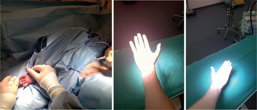 Figure 6 
            (left) Photos taken with object of interest located outside the central light field, (middle and right) Impact of different light intensities (highest and lowest) on picture quality.
          