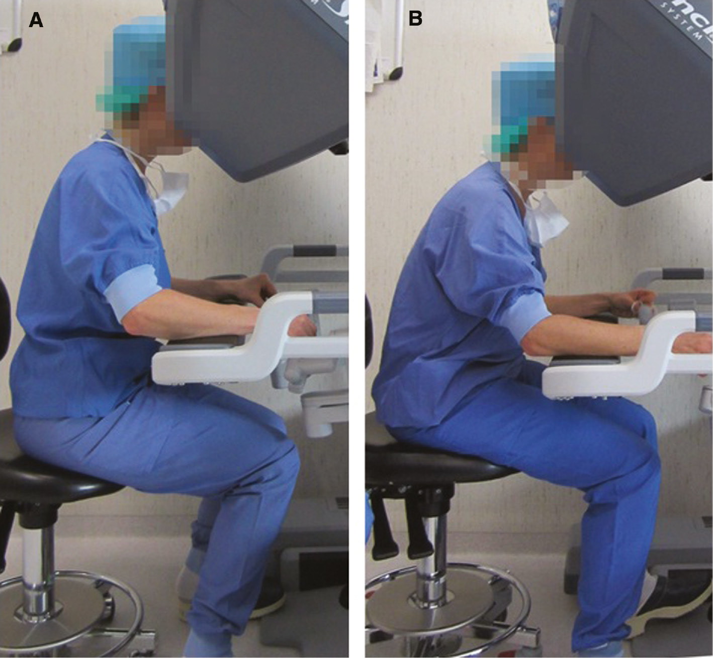 Figure 5: (A) Participant 3 photographed on the first day and (B) the same participant during a similar procedure on the next day.It can be seen that the participant did not adjust the chair height. This results in a less ergonomic position.