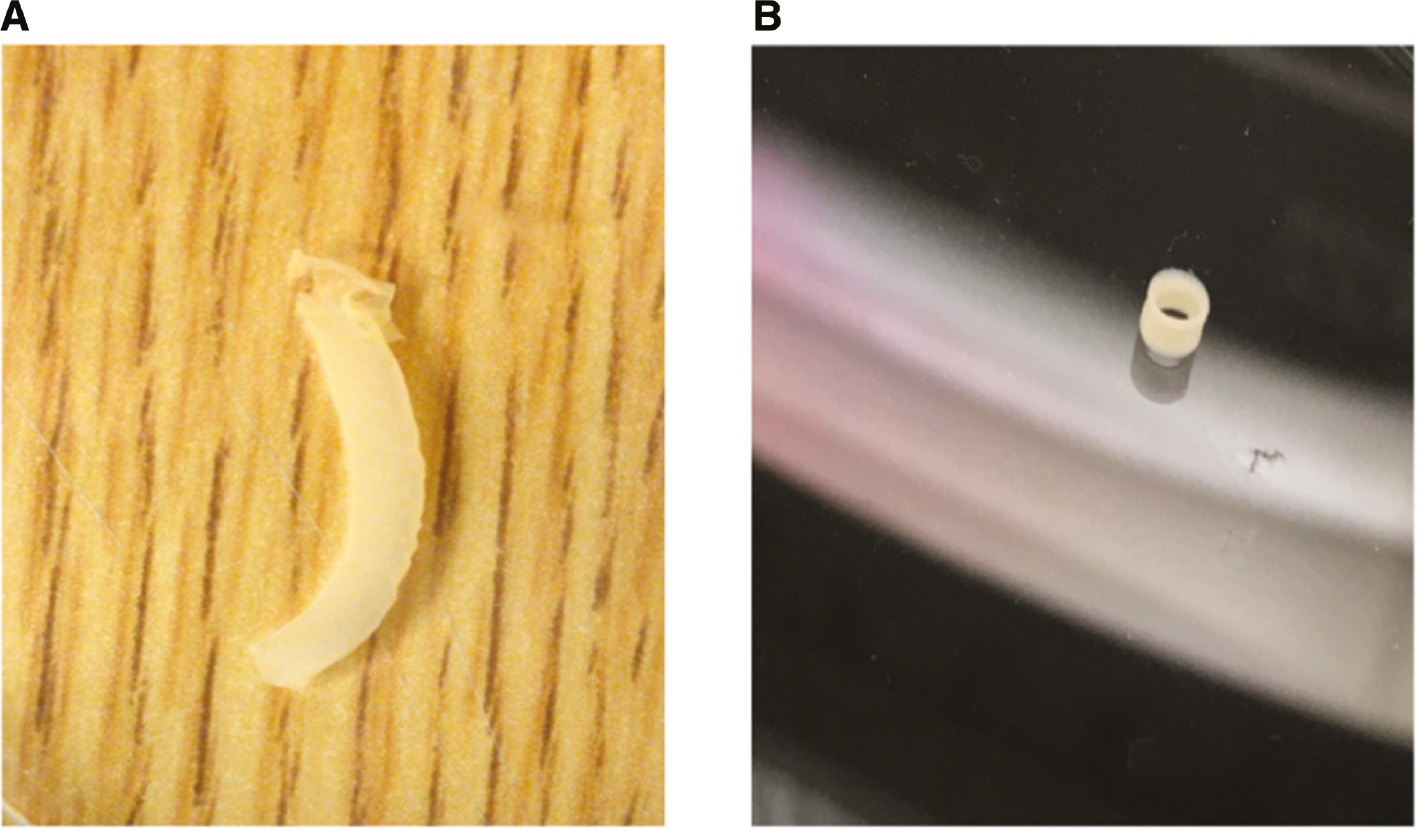 Figure 3: Scaffold-free vascular bioprints.(A) Full-length bioprinted vascular conduit that is scaffold free. (B) The bioprints can be sized to vascular conduits of different lengths and still remain patent.