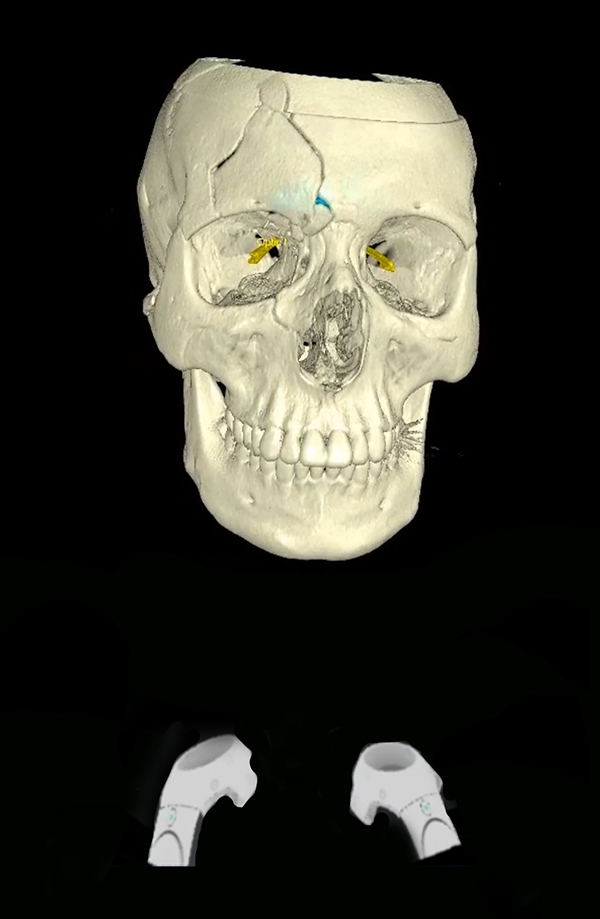 Figure 4: 
Virtual reality environments completely separate the user from their physical environment while allowing the user to manipulate virtual objects.