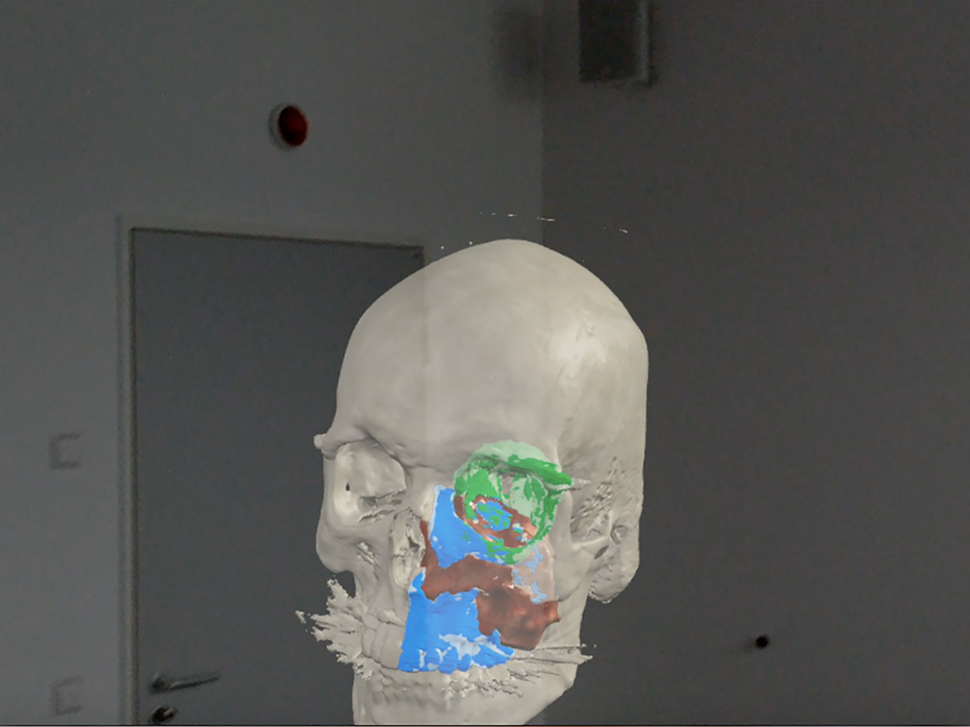 Figure 6: 
Mixed realith tools allow the user to visualize their environment, superimposing virtual objects into the environment that can be manipulated.