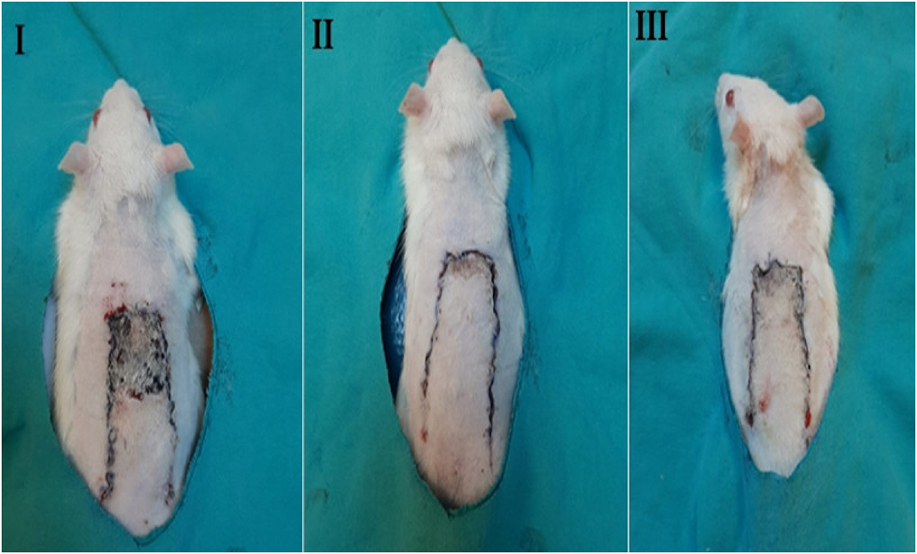 Figure 1: 
Quantitative comparison of flap necrosis area (%) among the three experimental groups on postoperative day 7. Group I (control): flap surgery without treatment. Group II (MLT): treated with medicinal leeches applied to the flap center. Group III (LSE): treated with subcutaneous injection of leech saliva extract.
