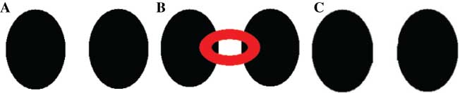 Figure 16 Curved Structure Reconstruction: Patch Size 9×9.