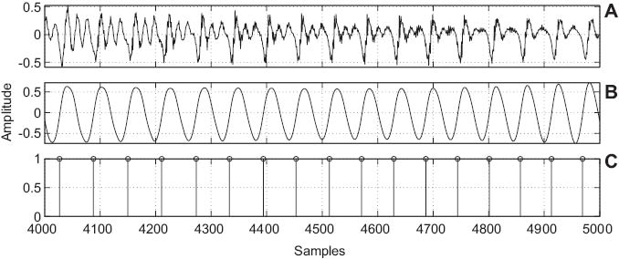 Figure 1 Epoch (GCI) Extraction Using the ZFF Method: (A) Segment of Voiced Speech Signal, (B) Local Mean Subtracted ZFF Signal, and (C) Epoch Locations from ZFF Signal.