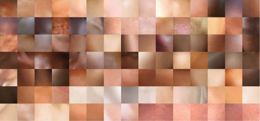 Figure 1 Samples of Human Skin.