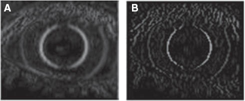 Figure 8. Result of the Local Maxima Preserving Process.(A) Image after the correction of the contrast. (B) Result of the local maxima preserving process.