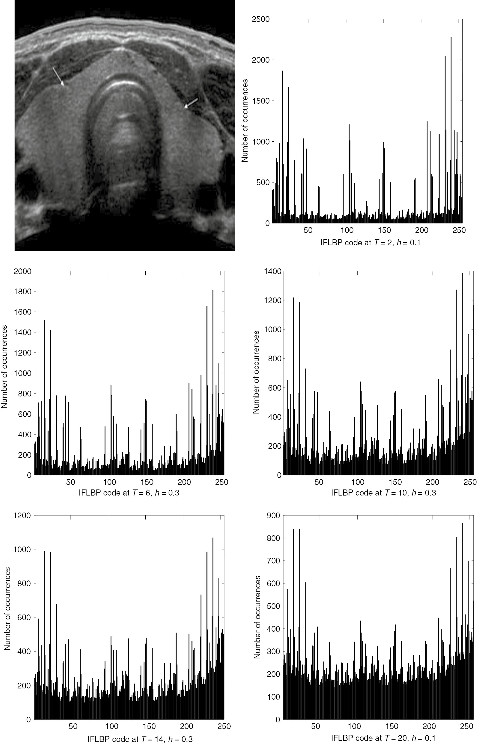 Figure 4: Histogram Plot of IFLBP Codes for Thyroid Image.