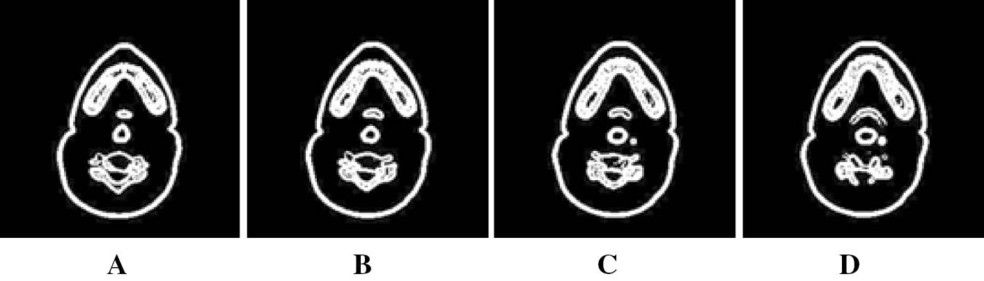 Figure 3: Phase Field segmented results of a human head CT. (A–D) corresponds to segmentation results of images in Figure 2.